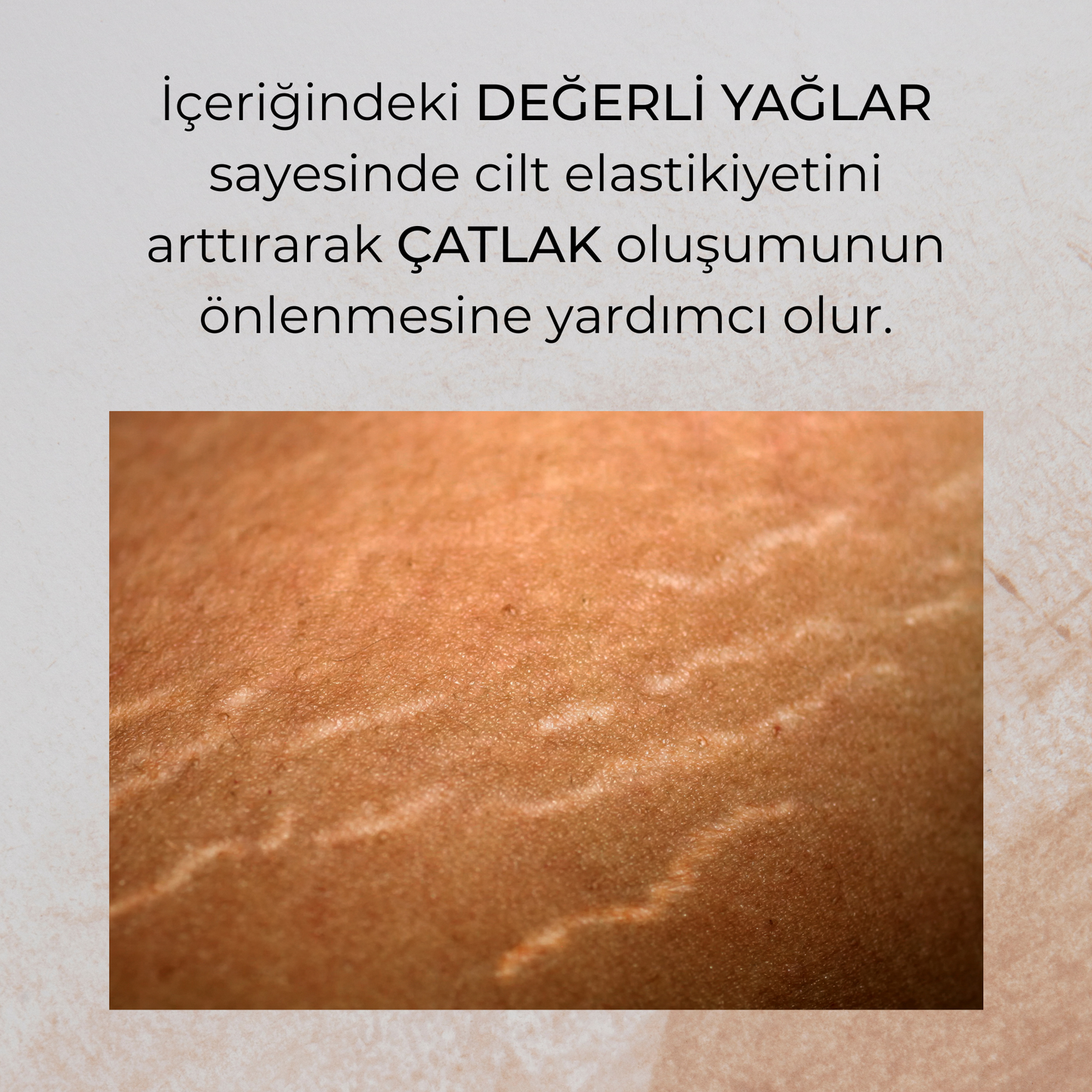 Yoğun Nemlendirici Vücut Losyonu - 180ml